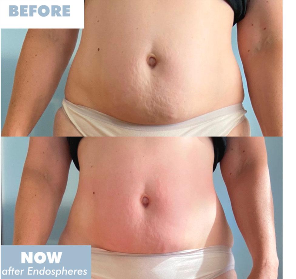 Visible after 1 session